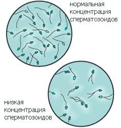 Мужское бесплодие