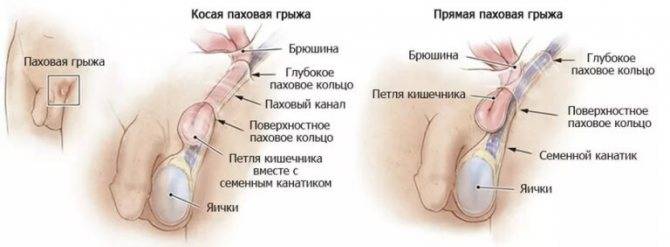 Почему у мужчины может болеть промежность