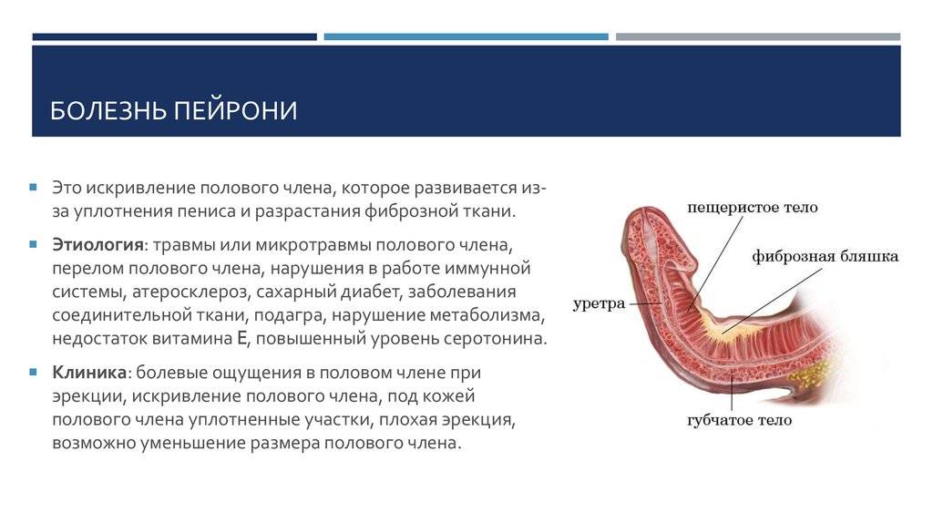 Покраснение головки члена фото