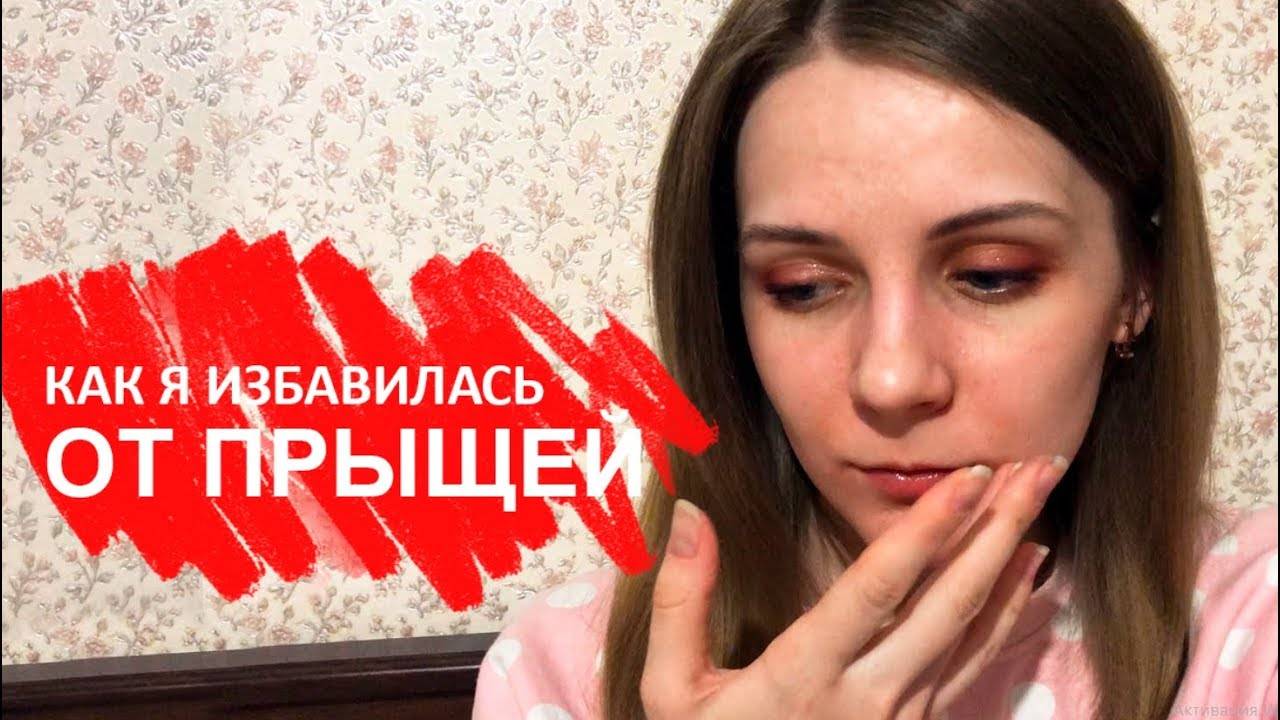 Как вылечить прыщи после мильгаммы