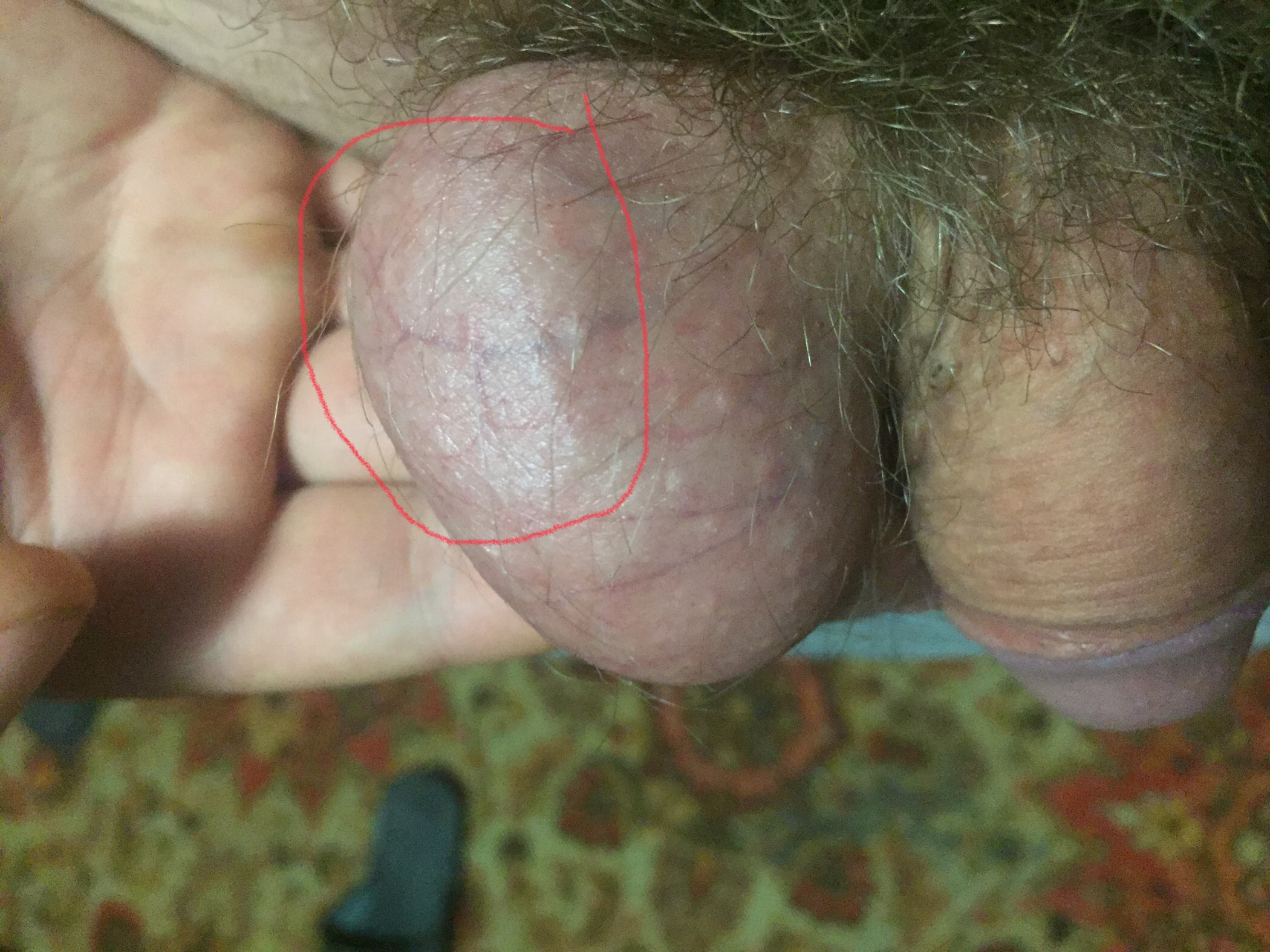 шишка между грудей у мужчин фото 104