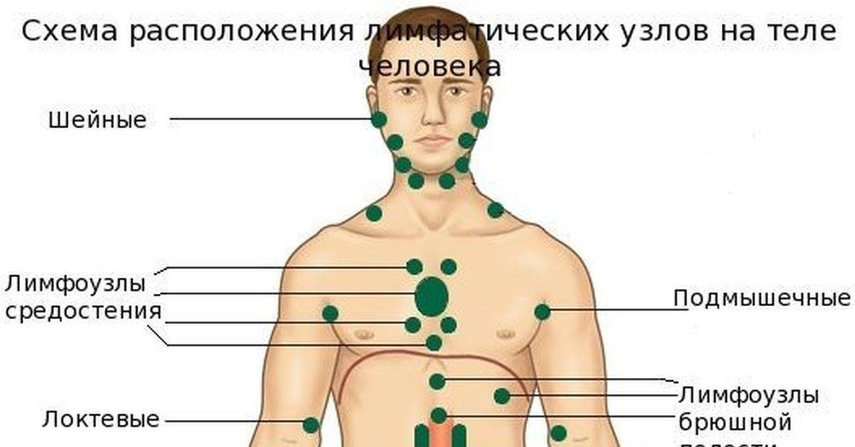 О чем говорят увеличенные лимфоузлы в паху у мужчин