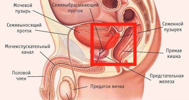 Воспаление семенных пузырьков (везикулит): причины, симптомы и лечение