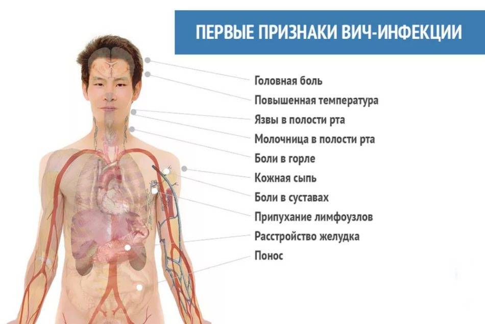 Первые симптомы вич