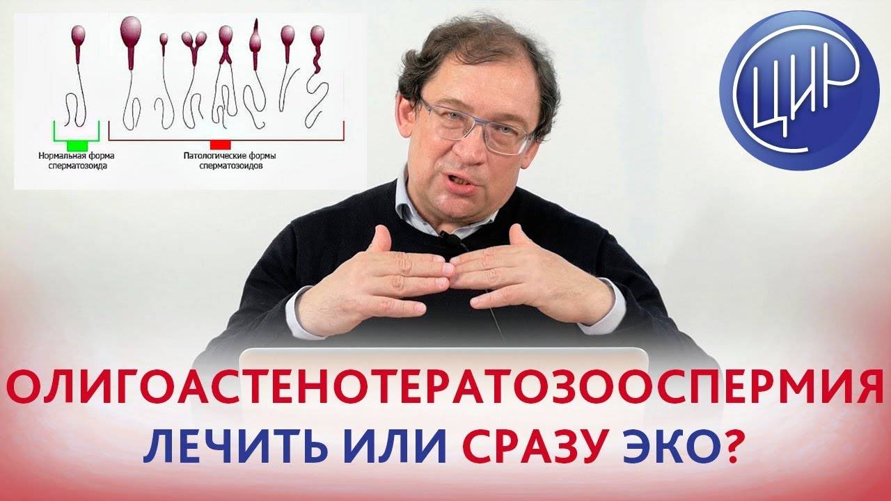 Олигоастенотератозооспермия лечение и диагностика
