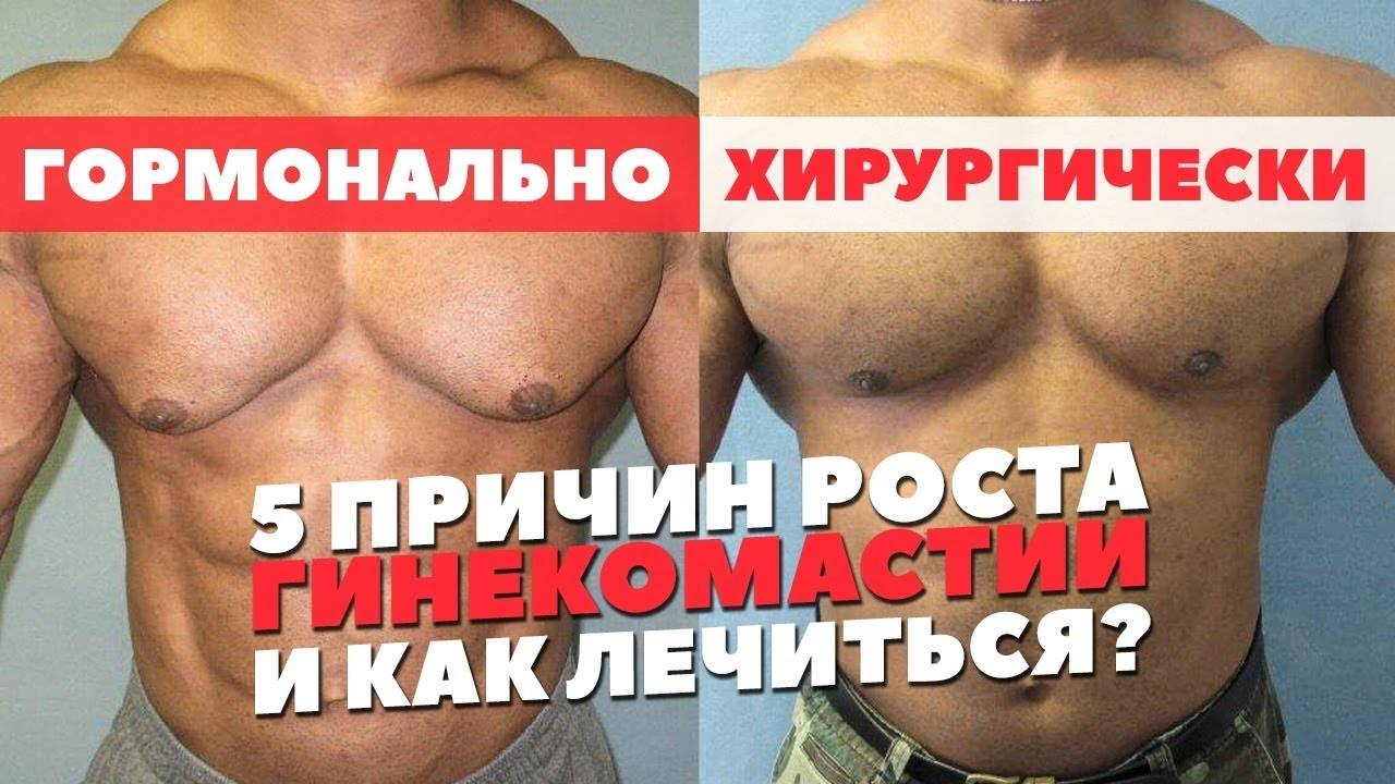 Низкий тестостерон у мужчин — симптомы, лечение. признаки низкого тестостерона у мужчин