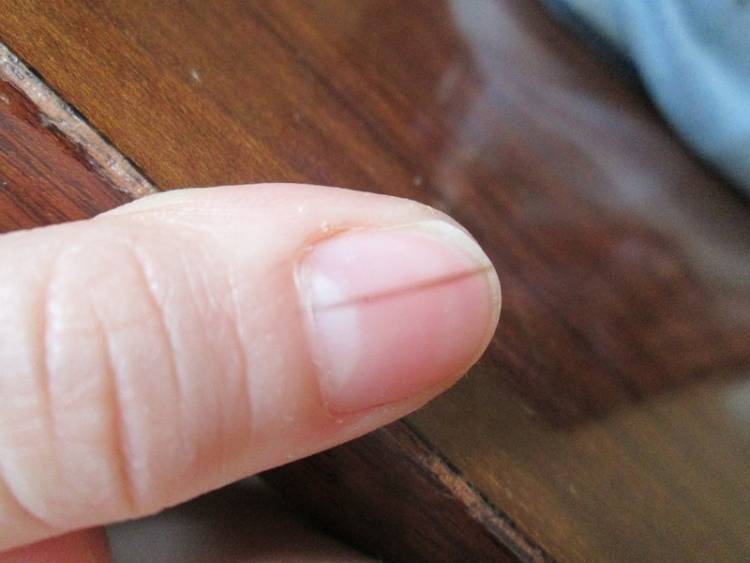 Как избавиться от волос на пальцах рук у мужчин