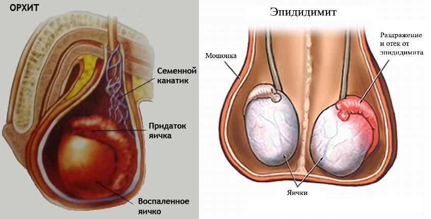 Семенники